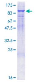 SDS-PAGE (F2-3610H).jpg